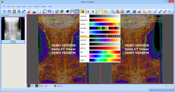 Sante CT Viewer screenshot 2