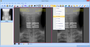 Sante CT Viewer screenshot 3
