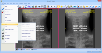 Sante CT Viewer screenshot 4