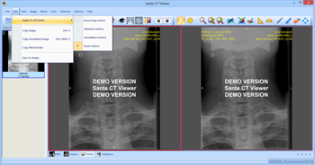 Sante CT Viewer screenshot 5