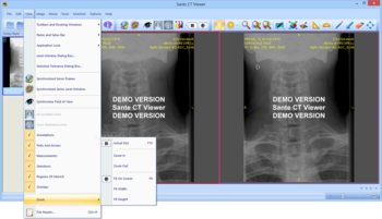 Sante CT Viewer screenshot 6
