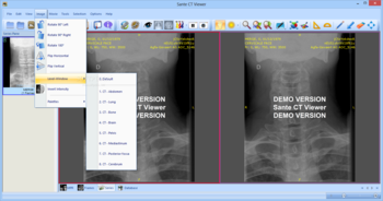 Sante CT Viewer screenshot 7