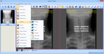 Sante CT Viewer screenshot 8