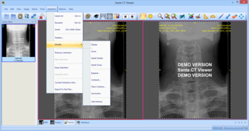 Sante CT Viewer screenshot 9