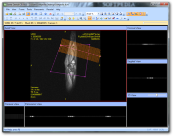 Sante Dental CT Free screenshot