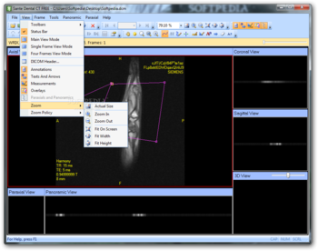 Sante Dental CT Free screenshot 3