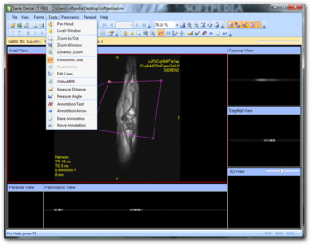 Sante Dental CT Free screenshot 4