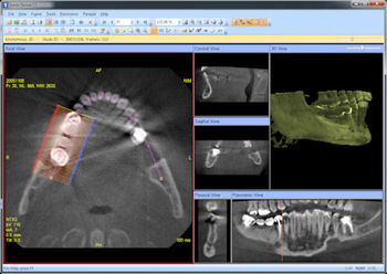 Sante Dental CT screenshot