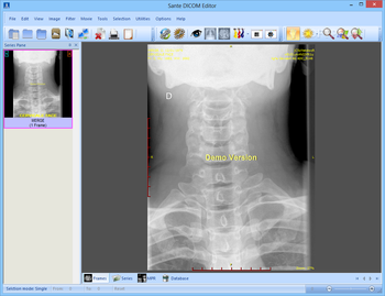 Sante DICOM Editor screenshot