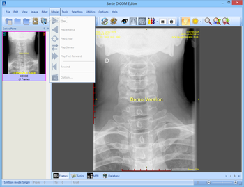 Sante DICOM Editor screenshot 10