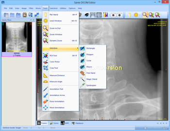 Sante DICOM Editor screenshot 11