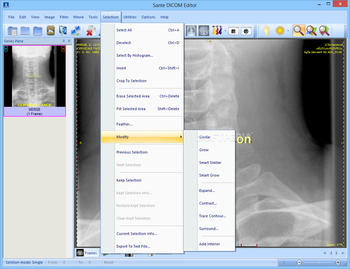 Sante DICOM Editor screenshot 12