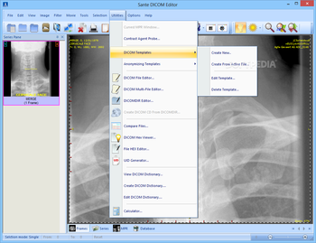 Sante DICOM Editor screenshot 13