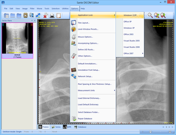 Sante DICOM Editor screenshot 14