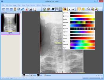 Sante DICOM Editor screenshot 2