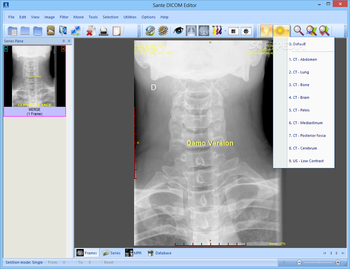 Sante DICOM Editor screenshot 3