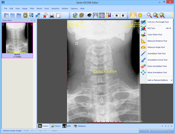 Sante DICOM Editor screenshot 4