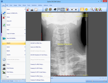 Sante DICOM Editor screenshot 5