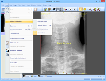 Sante DICOM Editor screenshot 6