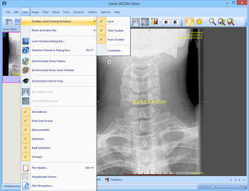 Sante DICOM Editor screenshot 7