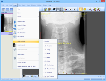 Sante DICOM Editor screenshot 8