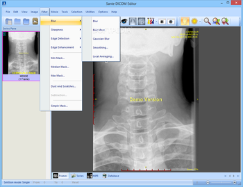 Sante DICOM Editor screenshot 9