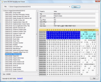 Sante DICOM HEXViewer screenshot