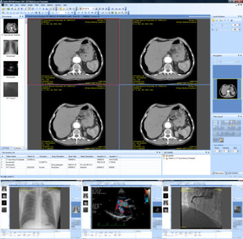 Sante DICOM Viewer CDR screenshot