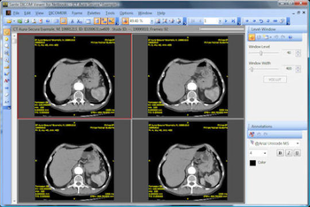 Sante DICOM Viewer for Netbooks screenshot