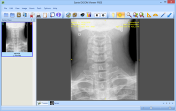 Sante DICOM Viewer FREE screenshot