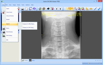 Sante DICOM Viewer FREE screenshot 2