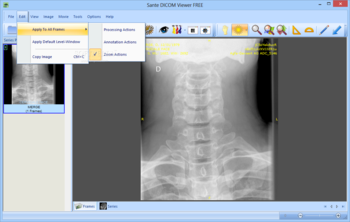 Sante DICOM Viewer FREE screenshot 3