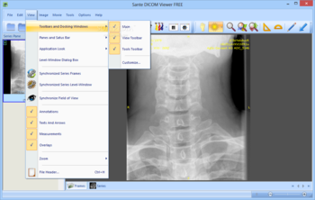 Sante DICOM Viewer FREE screenshot 4