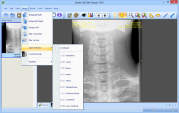 Sante DICOM Viewer FREE screenshot 5