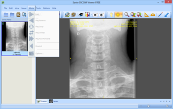 Sante DICOM Viewer FREE screenshot 6