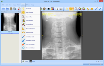 Sante DICOM Viewer FREE screenshot 7