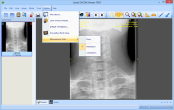 Sante DICOM Viewer FREE screenshot 8