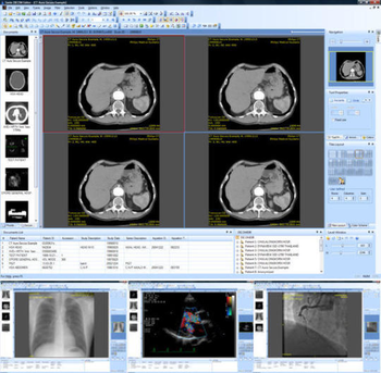 Sante DICOM Viewer PRO screenshot