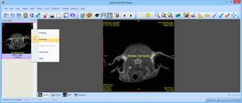 Sante DICOM Viewer screenshot