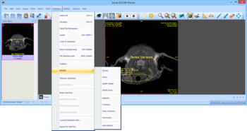 Sante DICOM Viewer screenshot 10