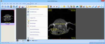 Sante DICOM Viewer screenshot 11