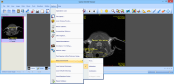 Sante DICOM Viewer screenshot 12