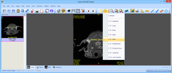 Sante DICOM Viewer screenshot 2