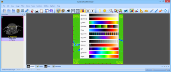 Sante DICOM Viewer screenshot 3