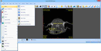 Sante DICOM Viewer screenshot 4