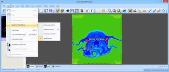 Sante DICOM Viewer screenshot 5