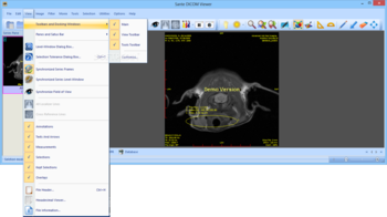 Sante DICOM Viewer screenshot 6