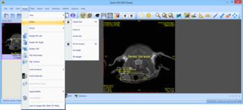 Sante DICOM Viewer screenshot 7