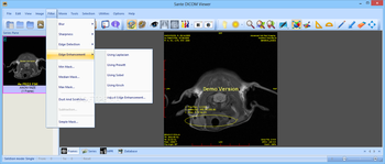 Sante DICOM Viewer screenshot 8