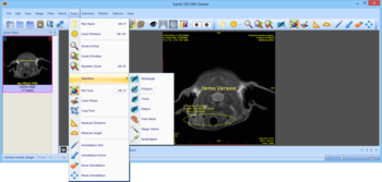 Sante DICOM Viewer screenshot 9